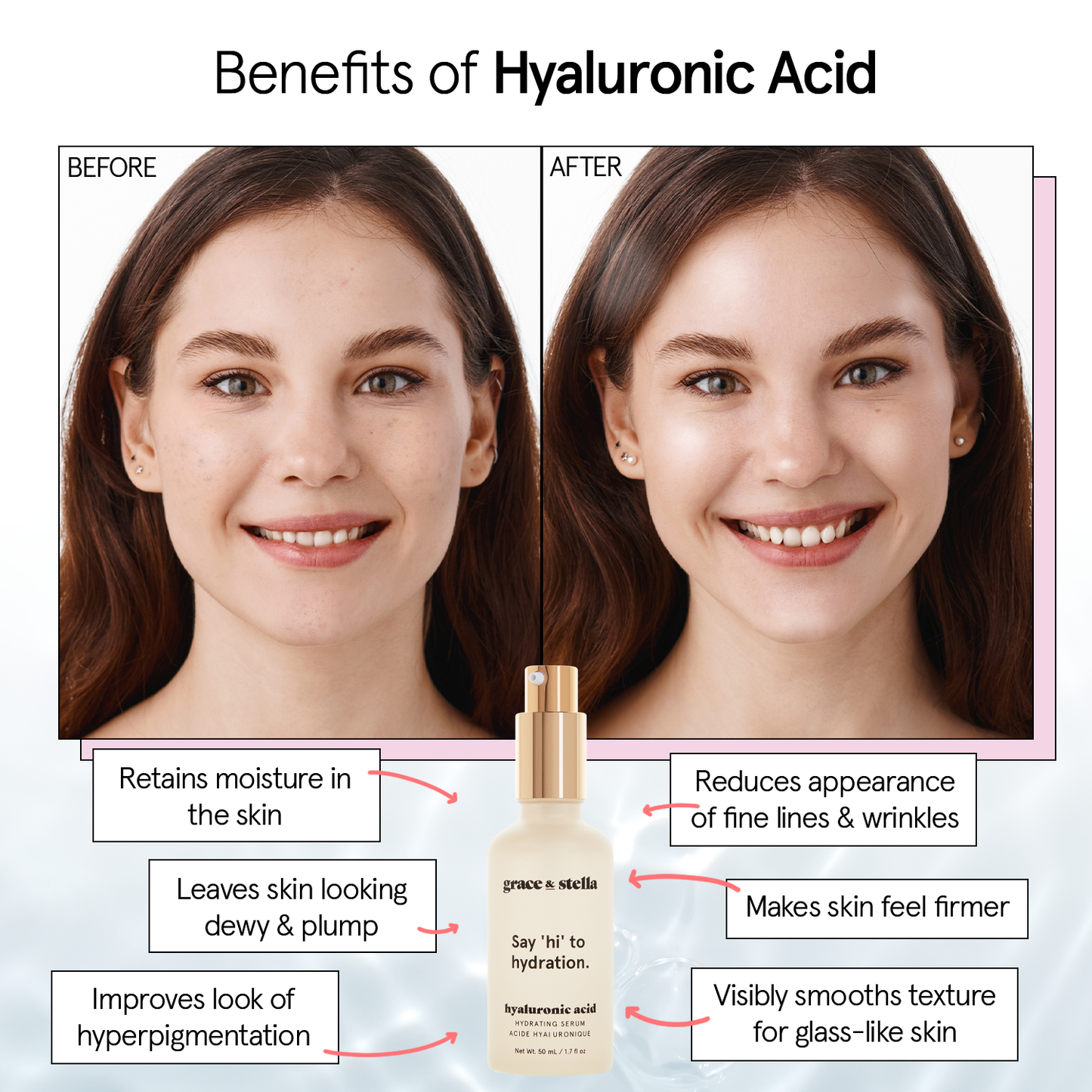 Hyaluronic Acid Serum: 10 mL (0.34 fl oz)